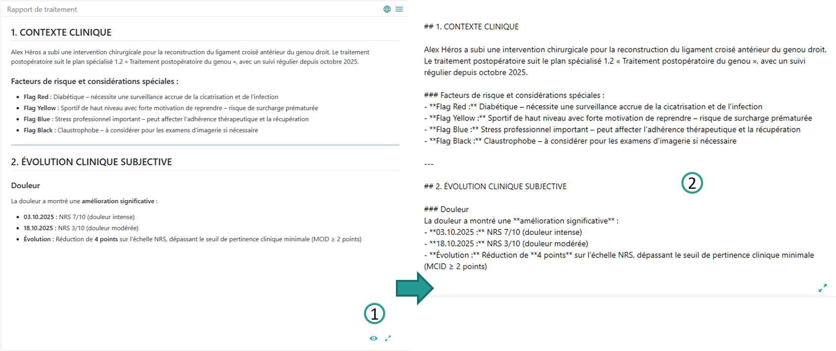 Vue-Markdown
