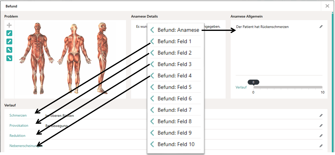 Zuordnung der Platzhalter