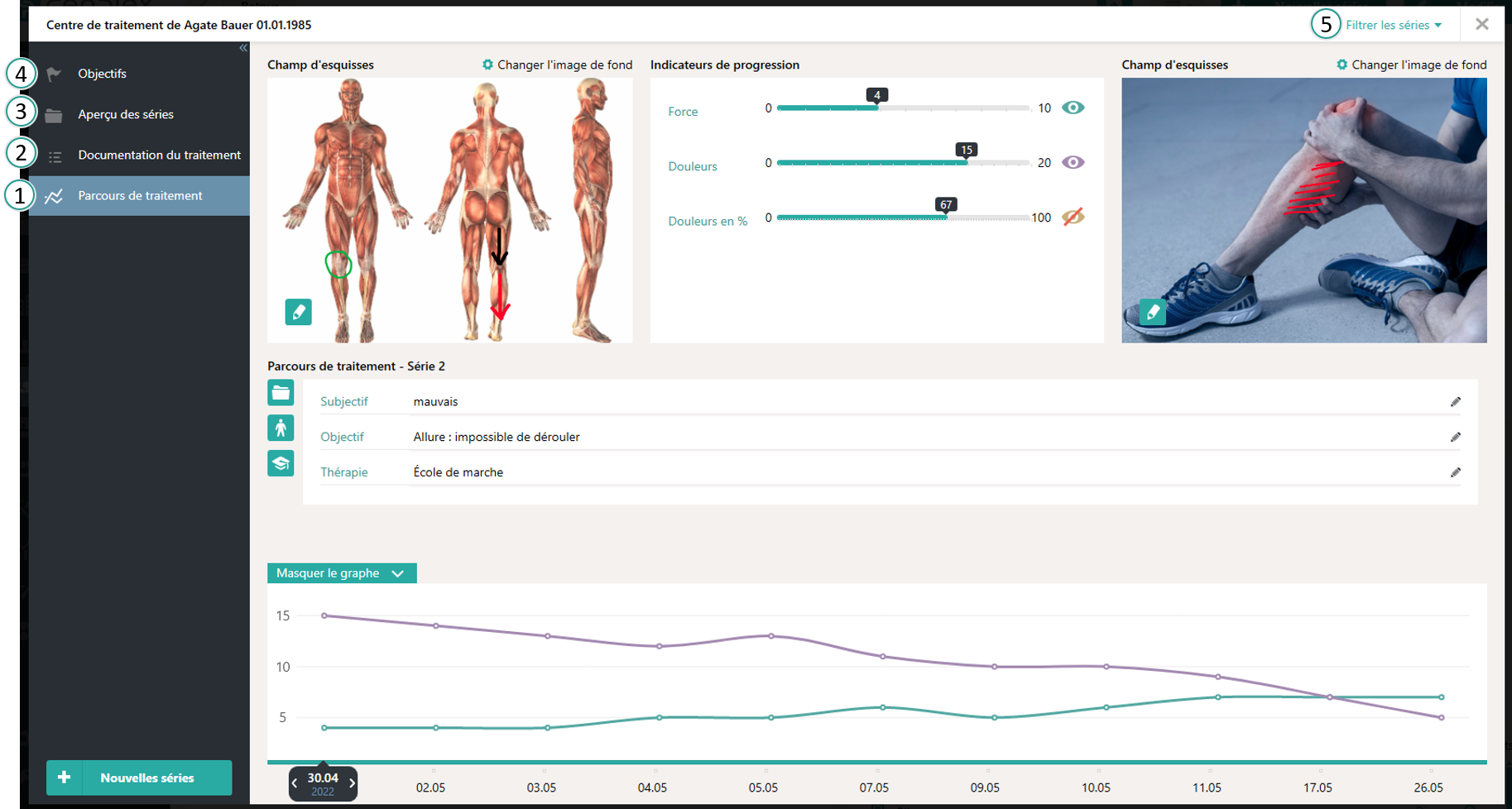 Parcours du patient visuel
