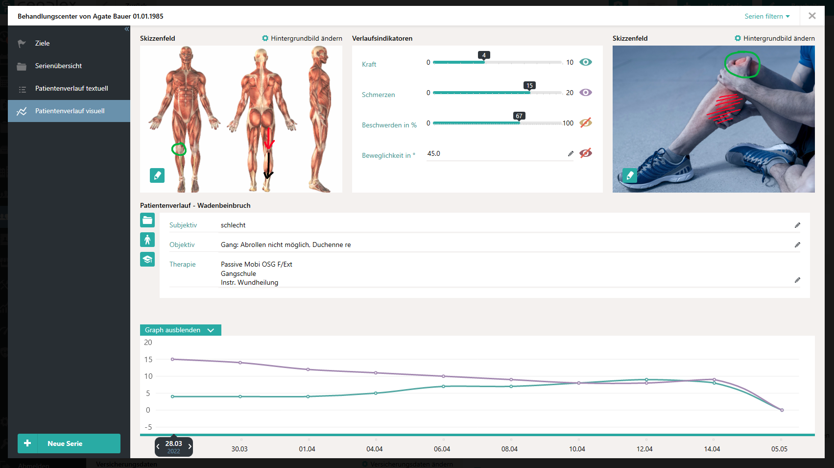 Patientenverlauf visuell &Uuml;bersicht