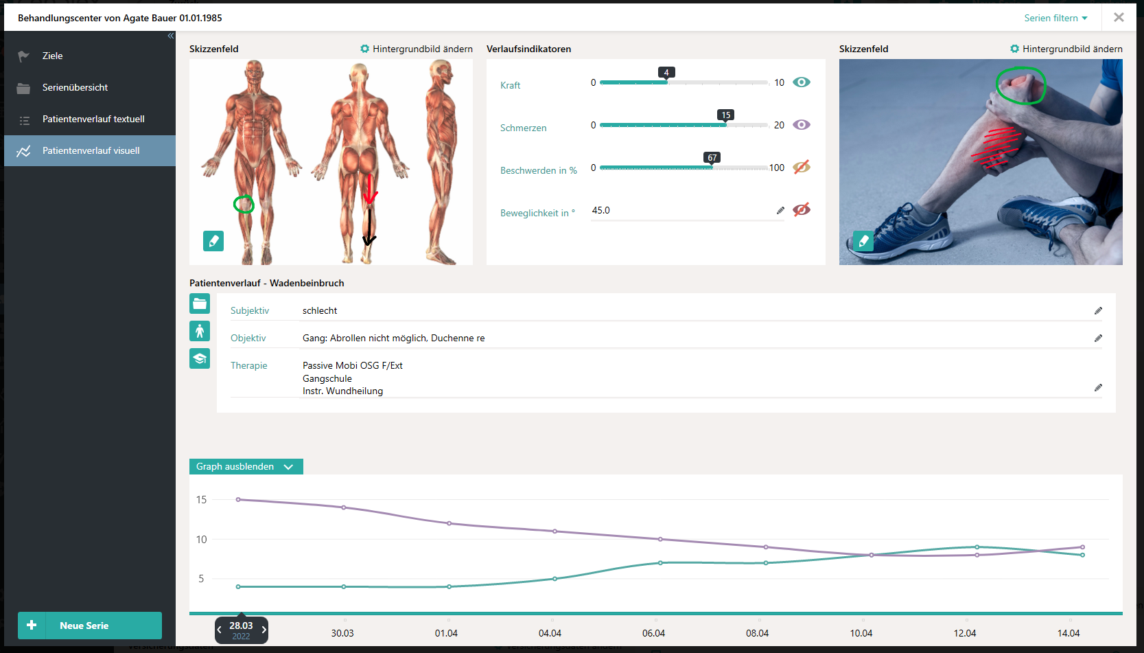 Historique du patient visuel